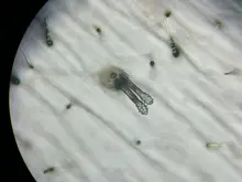 Centro de Investigaciones Biomédicas  de la UQ es pionero en diagnóstico de Demodex